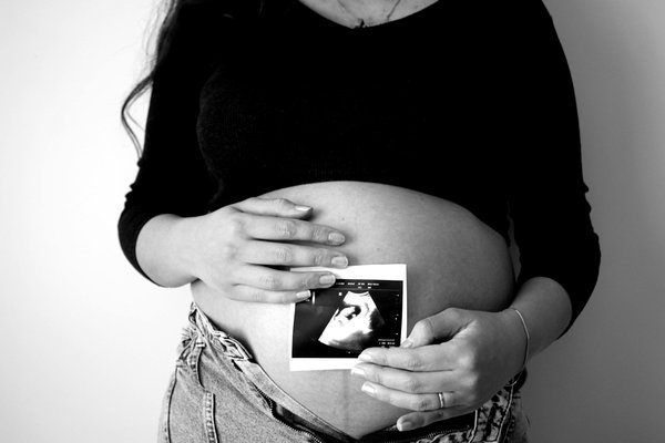 Top 5 astuces pour apaiser une migraine en moins d'une minute